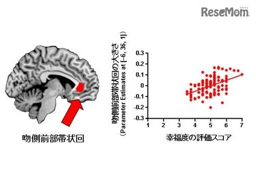 幸福度と吻側前部帯状回の大きさとの関連