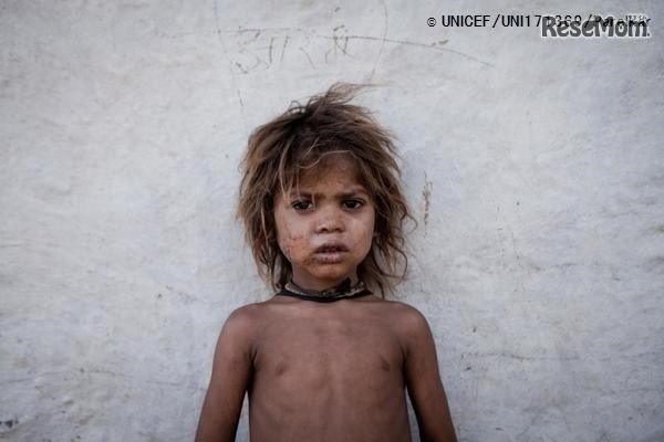 ビルケラ・ダーン村に住む、サハリア族のループシンちゃん（4歳）。（インド・ラージャスターン州　2014年5月30日撮影）(c) UNICEF_UNI171369_Parelkar