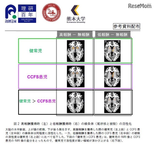 高報酬獲得時（左）と低報酬獲得時（右）の線条体の活性化